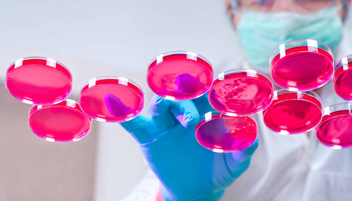 Liposome-mediated Transfection