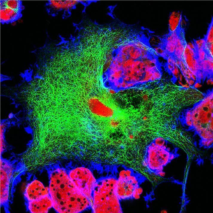 Protein Transfection Kits